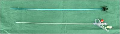 Flexible ureteroscopic lithotripsy with a suctioning ureteral access sheath for removing upper urinary calculi under local anesthesia